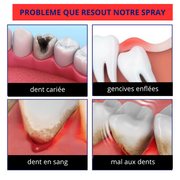 Spray anti-douleur dentaire